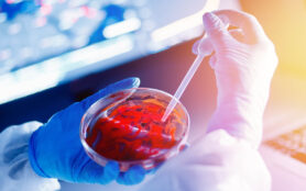 Development,Of,A,Vaccine,In,The,Laboratory,,Detection,Of,Antibodies
