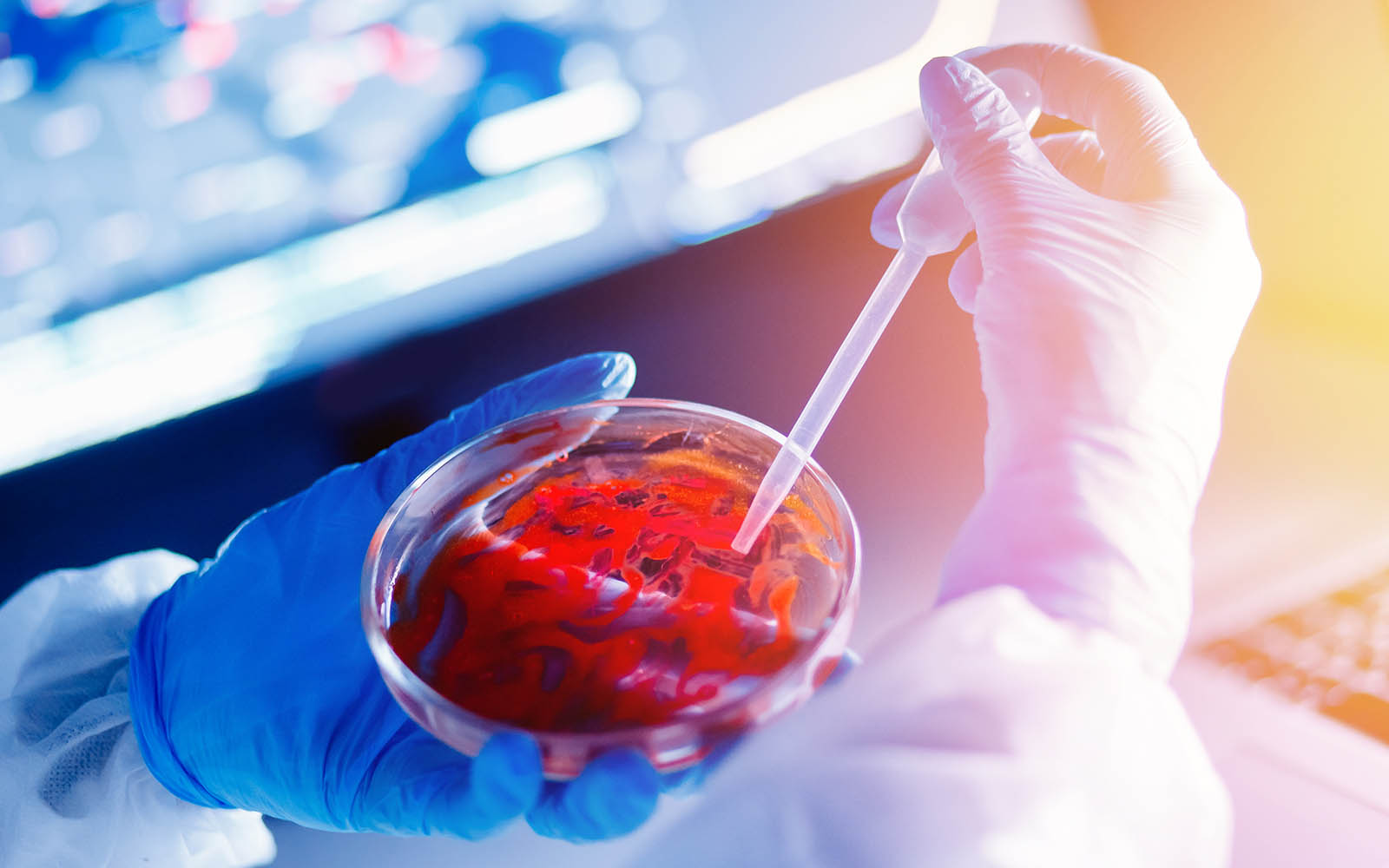 Serologie – Was ist das?