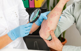 A,Dermatologist,Wearing,Gloves,Examines,The,Skin,Of,A,Sick