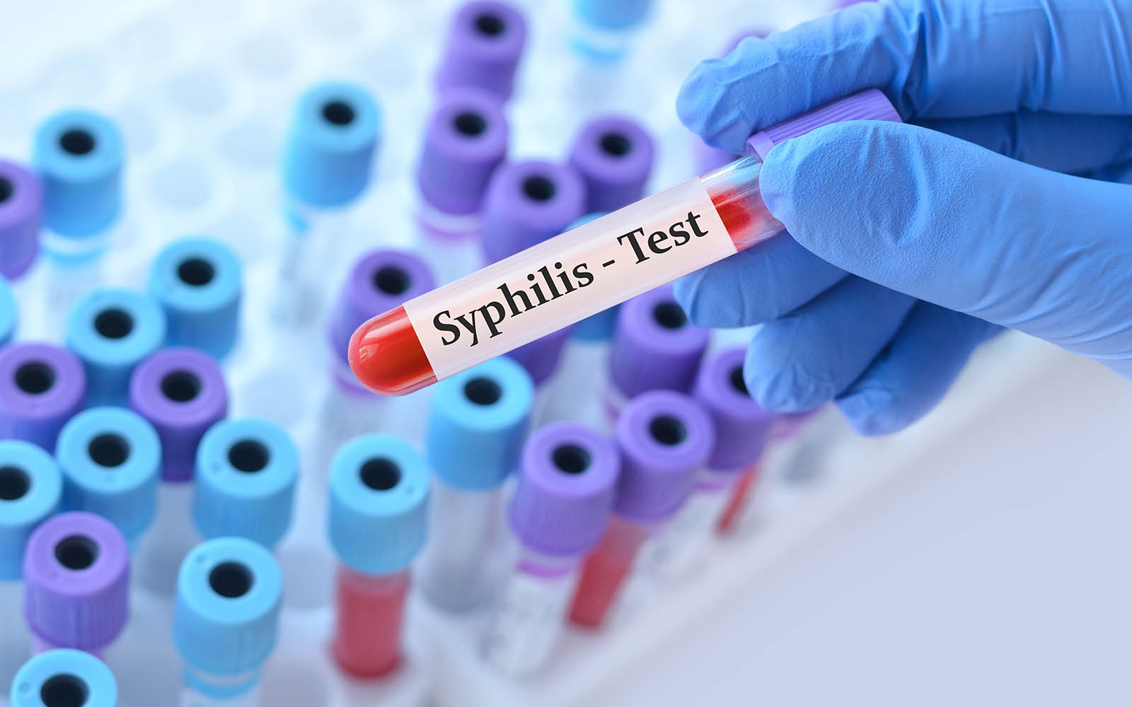 Syphilis – Übertragung, Infektion und Behandlung